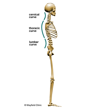 (1) Curvature of the spine