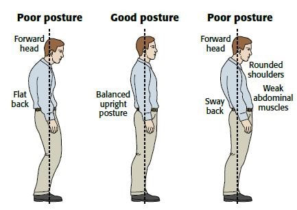 Examples of Poor & Good Posture